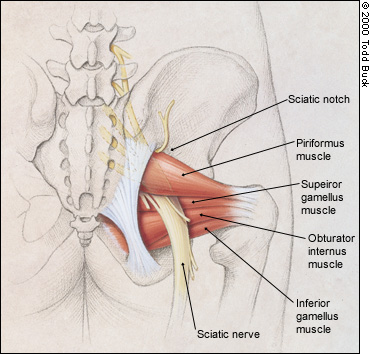 Piriformis Syndrome - Getting Hip Pain Working From Home